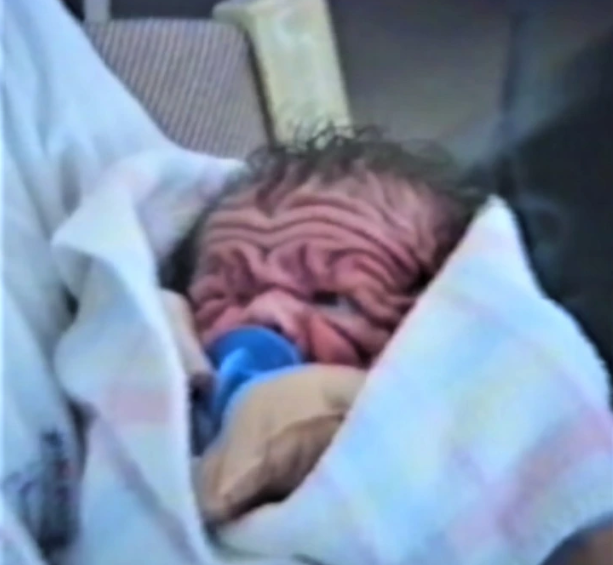 This baby was already five years old when he was born. Twenty years later This baby was already five years old when he was born. Twenty years later