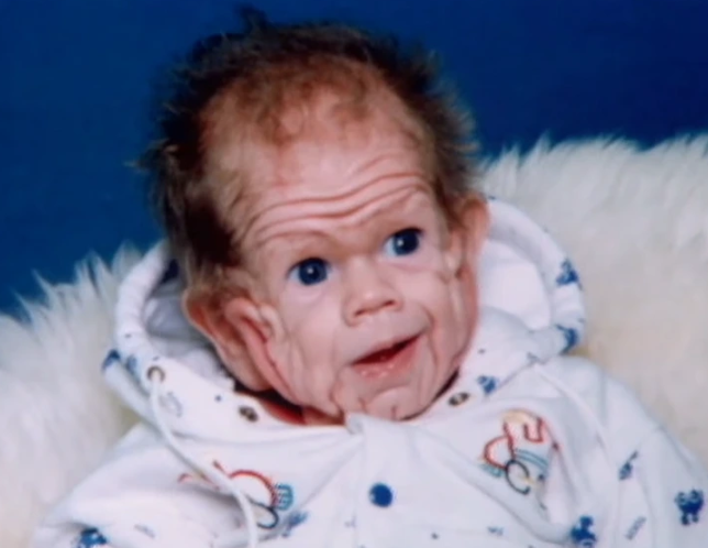 This baby was already five years old when he was born. Twenty years later This baby was already five years old when he was born. Twenty years later