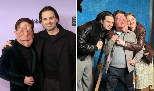 Top 10 World's Most Rare Conditions: Woman With Two Heads Top 10 World's Most Rare Conditions: Woman With Two Heads