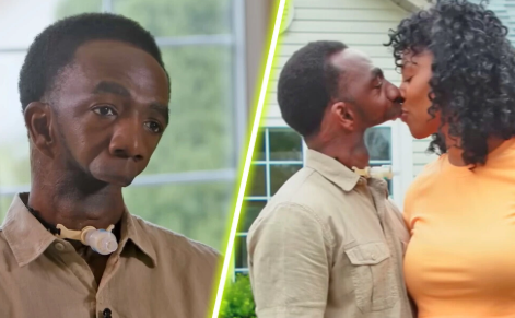 Top 10 World's Most Rare Conditions: Woman With Two Heads Top 10 World's Most Rare Conditions: Woman With Two Heads